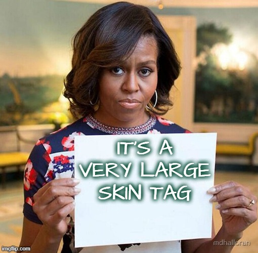 Michelle Obama Sign | IT'S A VERY LARGE SKIN TAG | image tagged in michelle obama sign | made w/ Imgflip meme maker