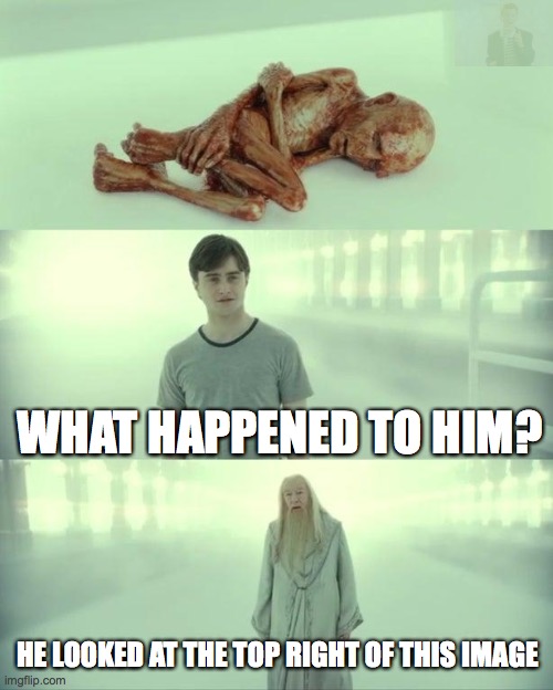 Dead Baby Voldemort / What Happened To Him | WHAT HAPPENED TO HIM? HE LOOKED AT THE TOP RIGHT OF THIS IMAGE | image tagged in dead baby voldemort / what happened to him | made w/ Imgflip meme maker