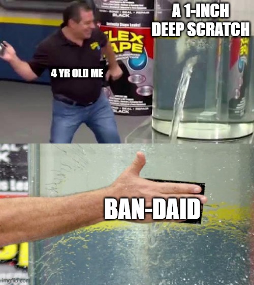 The scratch | A 1-INCH DEEP SCRATCH; 4 YR OLD ME; BAN-DAID | image tagged in flex tape | made w/ Imgflip meme maker