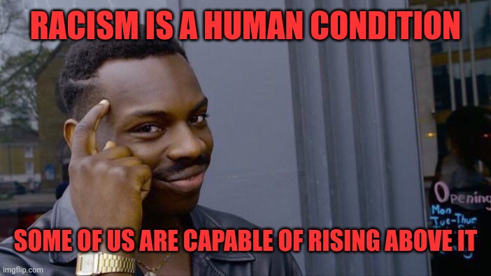Roll Safe Think About It Meme | RACISM IS A HUMAN CONDITION SOME OF US ARE CAPABLE OF RISING ABOVE IT | image tagged in memes,roll safe think about it | made w/ Imgflip meme maker