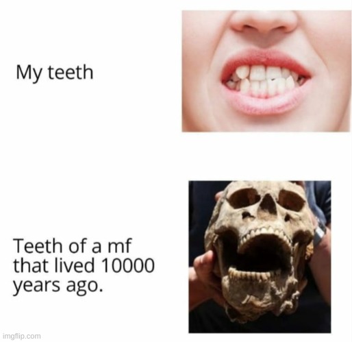 why is this so true- | image tagged in teeth,memes | made w/ Imgflip meme maker
