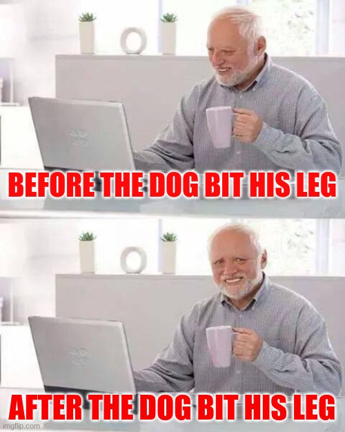 the god dang dog | BEFORE THE DOG BIT HIS LEG; AFTER THE DOG BIT HIS LEG | image tagged in memes,hide the pain harold | made w/ Imgflip meme maker