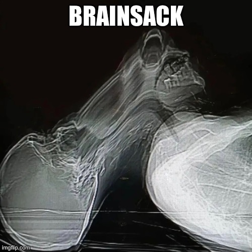 Brainsack | BRAINSACK | image tagged in pictures | made w/ Imgflip meme maker