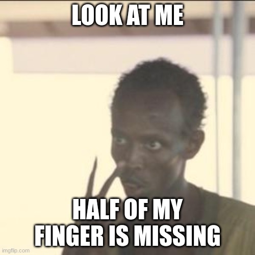 Look At Me | LOOK AT ME; HALF OF MY FINGER IS MISSING | image tagged in memes,look at me | made w/ Imgflip meme maker