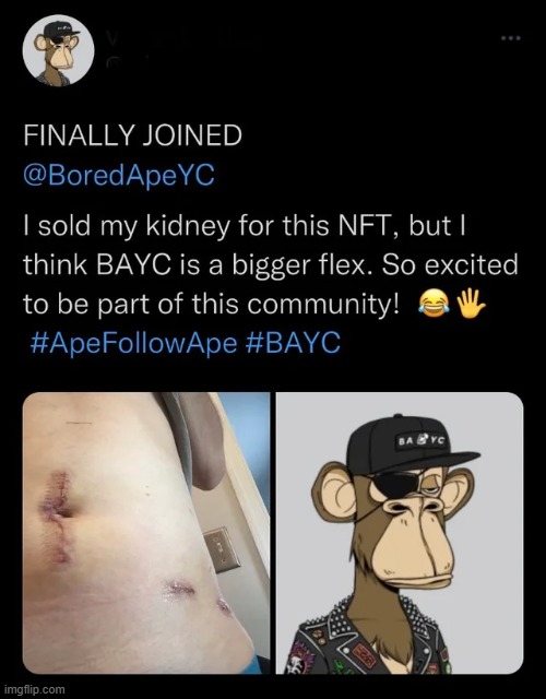 bro really sold one of his organs for a jpeg ☠️☠️☠️ | made w/ Imgflip meme maker