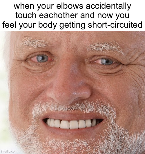am i the only one who suffers from this? (also applies to knees too) | when your elbows accidentally touch eachother and now you feel your body getting short-circuited | image tagged in hide the pain harold,pain,elbow,short circuit,it hurts | made w/ Imgflip meme maker