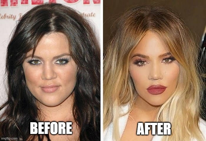 Kardashian Makeover. Where did the chin go? | BEFORE; AFTER | image tagged in kardashians,makeover,no more chin,hair,makeup | made w/ Imgflip meme maker