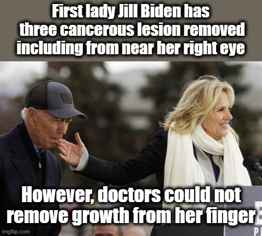 First lady Jill Biden has  three cancerous lesion removed including from near her right eye; However, doctors could not remove growth from her finger | image tagged in joe biden | made w/ Imgflip meme maker