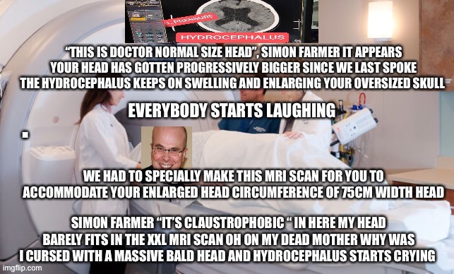 Simon Farmer At Queens Neurology in London His hydrocephalus is so severe and large and massive it broke the mri scan | . | image tagged in xray,ugly,big head,incel,virgin,loser | made w/ Imgflip meme maker