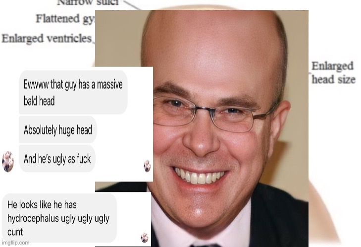 Simon Farmer | image tagged in ugly,big head,ugly guy,ugly face | made w/ Imgflip meme maker