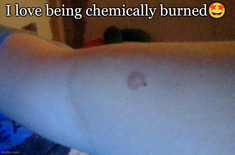 I love being chemically burned🤩 | made w/ Imgflip meme maker