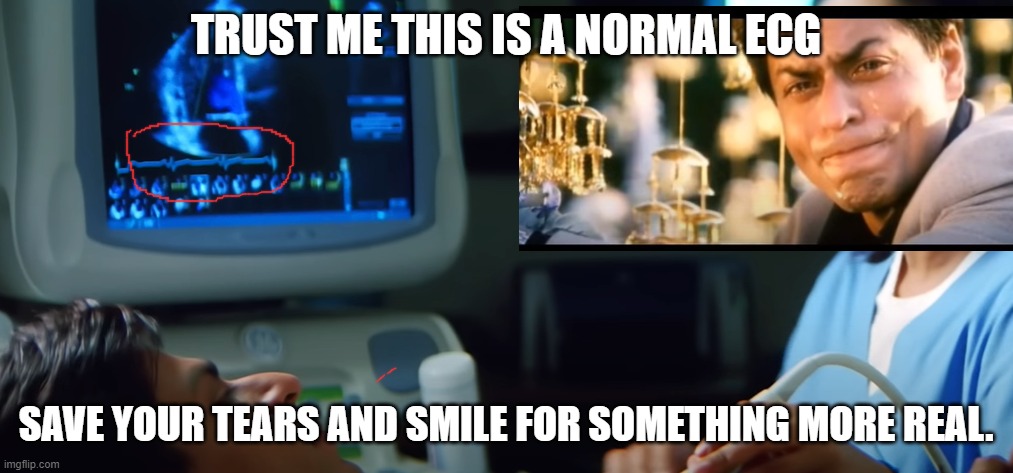 ecg memes | TRUST ME THIS IS A NORMAL ECG; SAVE YOUR TEARS AND SMILE FOR SOMETHING MORE REAL. | image tagged in indian | made w/ Imgflip meme maker