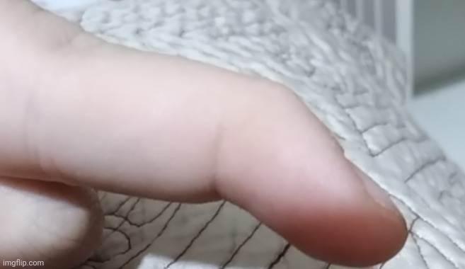 NOO MY FINGER BROKE | made w/ Imgflip meme maker