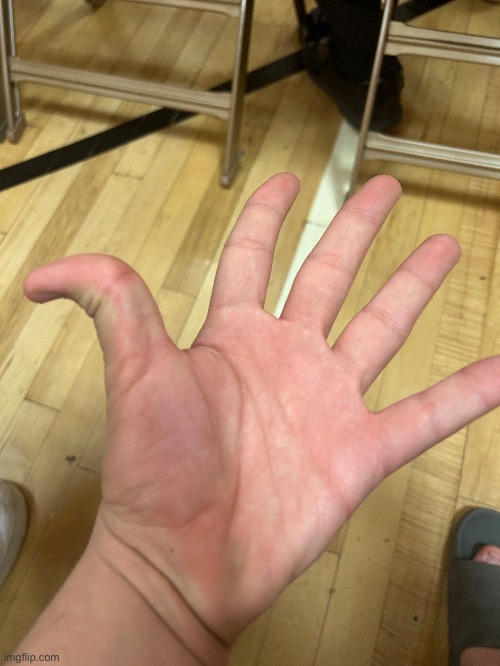 Hand reveal. (I broke my finger) | made w/ Imgflip meme maker