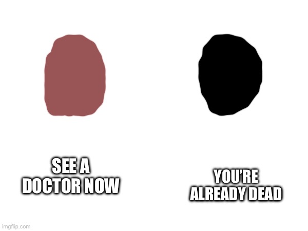 SEE A DOCTOR NOW YOU’RE ALREADY DEAD | made w/ Imgflip meme maker