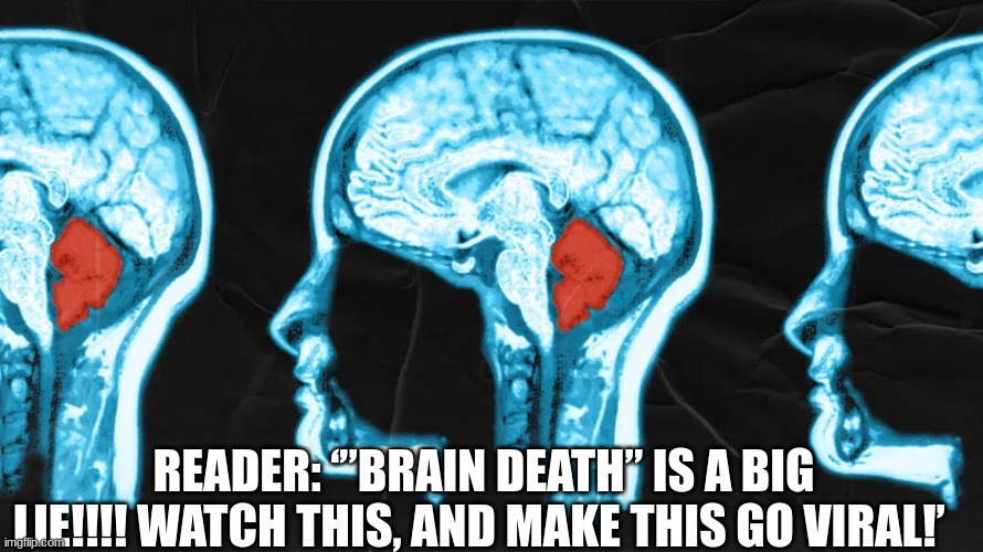 ‘”Brain Death” Is a Big Lie!!!! Watch This, and Make This Go Viral!’  (Video) 