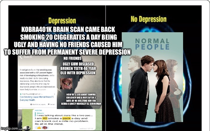 Kobra401k Has Clincal Depression From Being Ugly And Having No Friends | image tagged in ugly,ugly guy,depression,loser,unhappy,sad | made w/ Imgflip meme maker