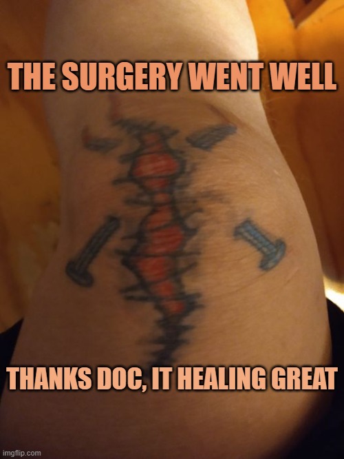 THE SURGERY WENT WELL; THANKS DOC, IT HEALING GREAT | image tagged in surgery | made w/ Imgflip meme maker
