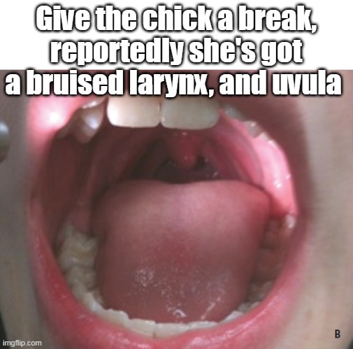 Give the chick a break, reportedly she's got a bruised larynx, and uvula | made w/ Imgflip meme maker