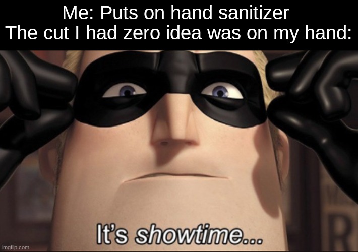 It's showtime | Me: Puts on hand sanitizer 
The cut I had zero idea was on my hand: | image tagged in it's showtime,funny,memes,gifs | made w/ Imgflip meme maker