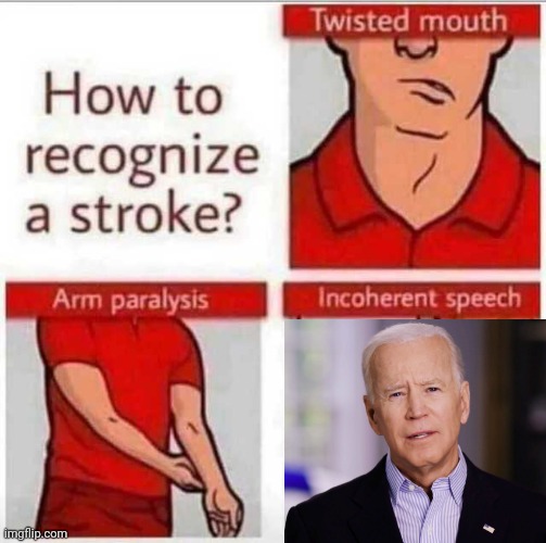 How to recognize a stroke | image tagged in how to recognize a stroke | made w/ Imgflip meme maker