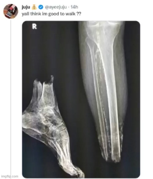 just a scratch | made w/ Imgflip meme maker