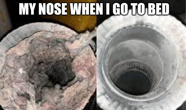 MY NOSE WHEN I GO TO BED | image tagged in my nose | made w/ Imgflip meme maker