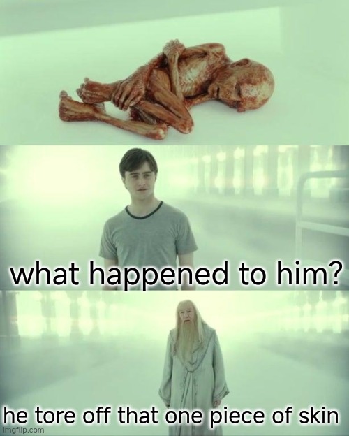 THE PAIN | what happened to him? he tore off that one piece of skin | image tagged in dead baby voldemort / what happened to him | made w/ Imgflip meme maker