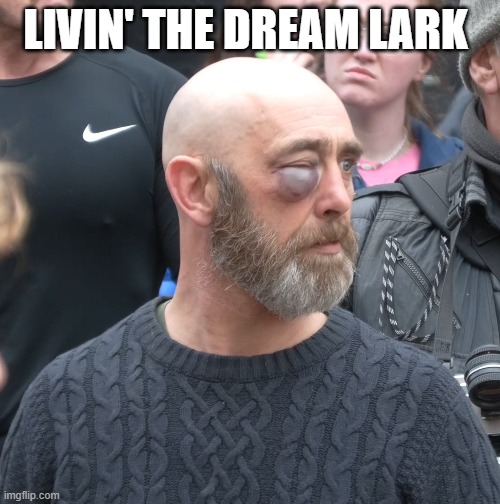 Atherstone Thug get's black eye during Ball game brawl | LIVIN' THE DREAM LARK | image tagged in event,fight,aggressive,chav,violence | made w/ Imgflip meme maker