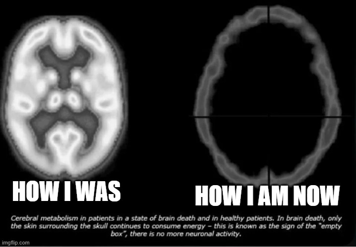 Healthy Brain vs Empty Brain | HOW I AM NOW; HOW I WAS | image tagged in healthy brain vs empty brain | made w/ Imgflip meme maker