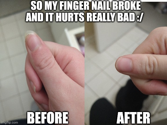 I'm in pain | SO MY FINGER NAIL BROKE AND IT HURTS REALLY BAD :/; BEFORE                   AFTER | image tagged in yay | made w/ Imgflip meme maker