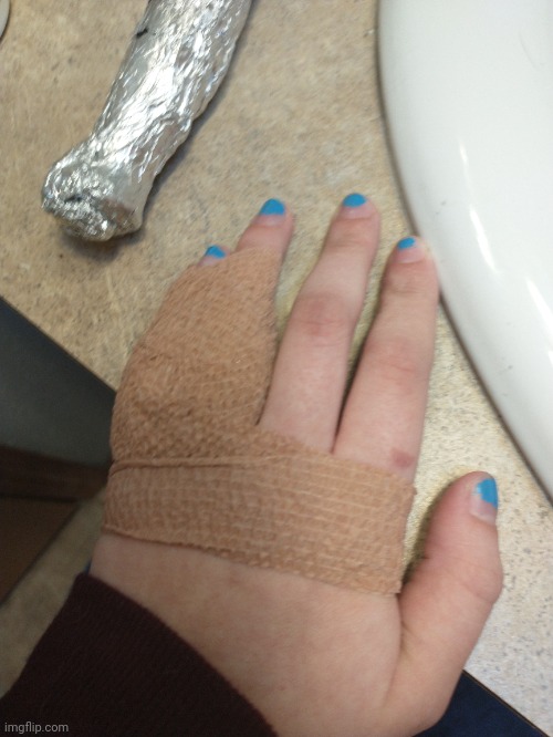 Everything bad happens to this hand, you can even see the burn I got a month ago | made w/ Imgflip meme maker