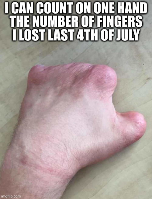 It was a blast | I CAN COUNT ON ONE HAND
THE NUMBER OF FINGERS
I LOST LAST 4TH OF JULY | image tagged in 4th of july,fireworks | made w/ Imgflip meme maker