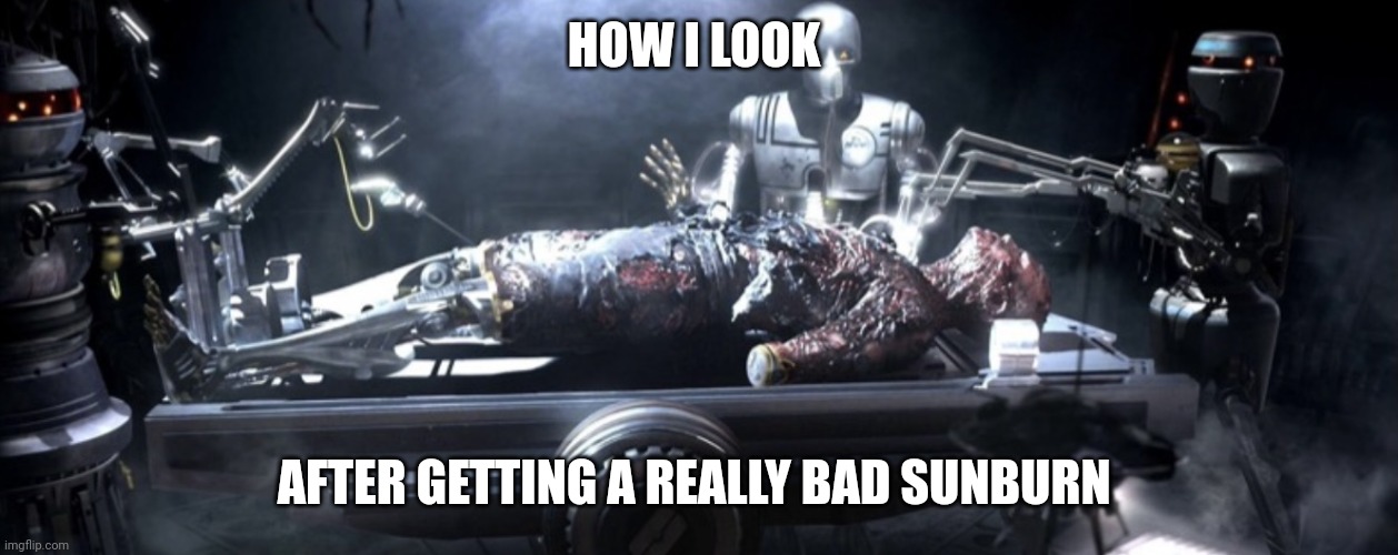 I ligit look like burned Anakin after getting sunburn | HOW I LOOK; AFTER GETTING A REALLY BAD SUNBURN | image tagged in darth vader in pain | made w/ Imgflip meme maker