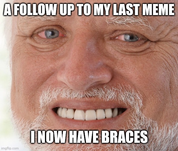 Saddness | A FOLLOW UP TO MY LAST MEME; I NOW HAVE BRACES | image tagged in hide the pain harold,braces | made w/ Imgflip meme maker
