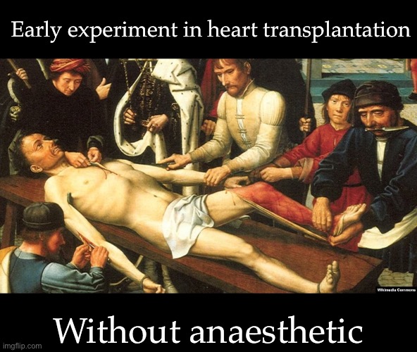 Early surgery | Early experiment in heart transplantation; Without anaesthetic | image tagged in broken heart,surgery,heart,transplant | made w/ Imgflip meme maker