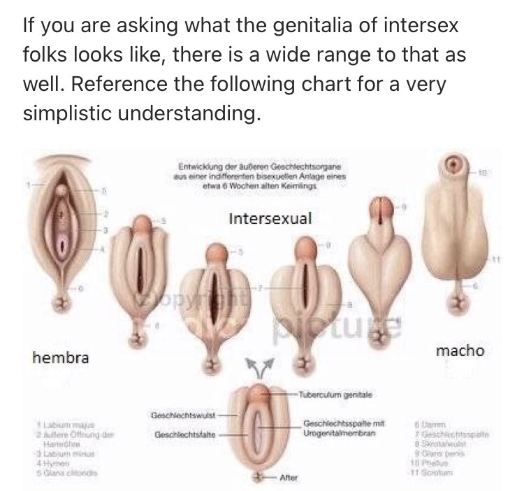 Intersex anatomy Blank Meme Template