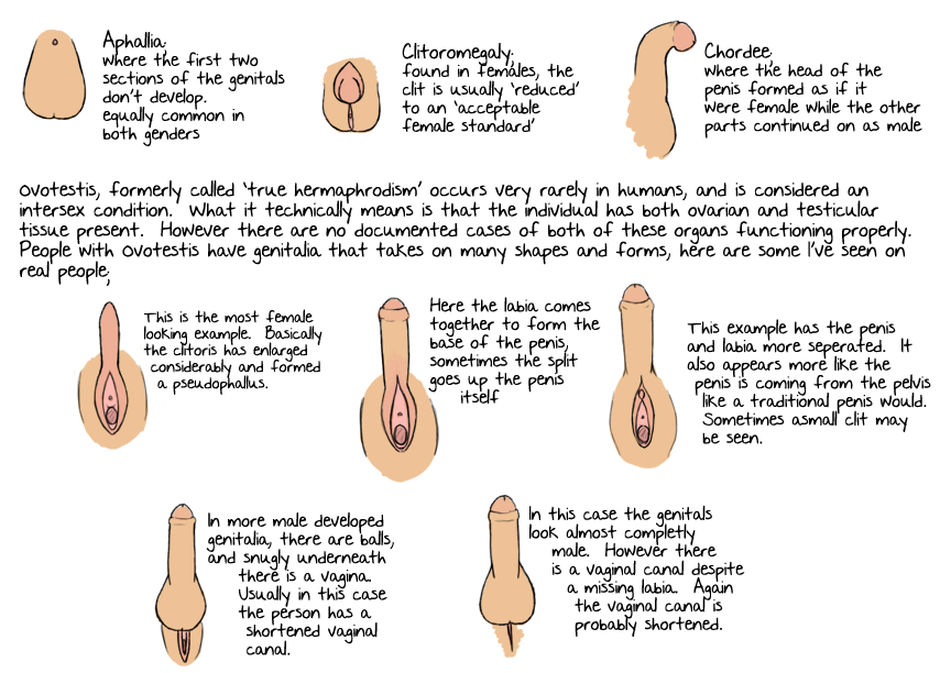 Intersex anatomy Blank Meme Template