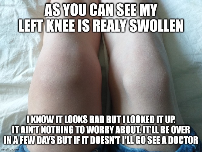 AS YOU CAN SEE MY LEFT KNEE IS REALY SWOLLEN; I KNOW IT LOOKS BAD BUT I LOOKED IT UP. IT AIN'T NOTHING TO WORRY ABOUT. IT'LL BE OVER IN A FEW DAYS BUT IF IT DOESN'T I'LL GO SEE A DOCTOR | made w/ Imgflip meme maker