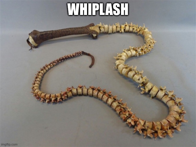 Whiplash | WHIPLASH | image tagged in whiplash,whip,whip nae nae,skeleton,spinal tap | made w/ Imgflip meme maker