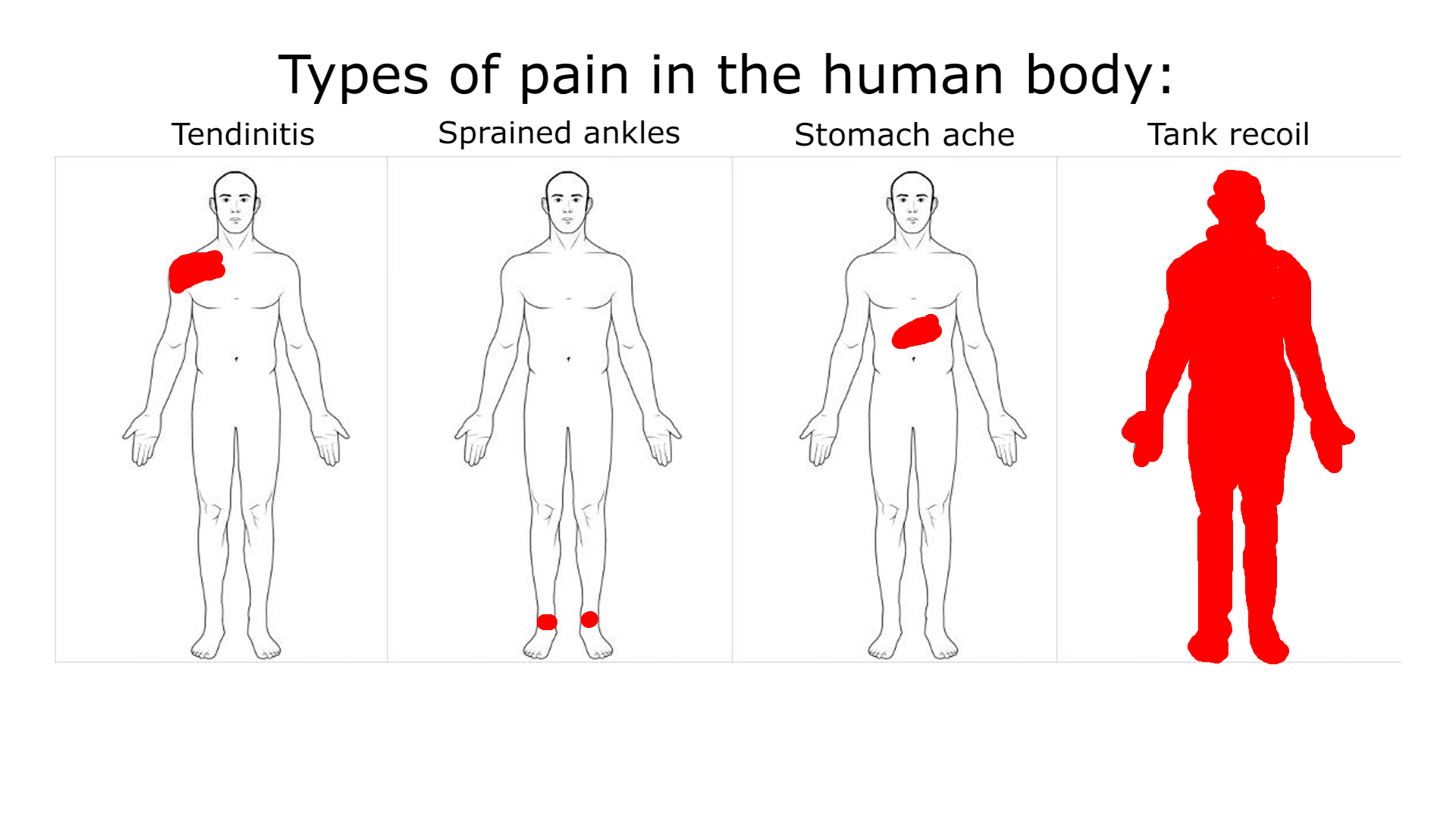 Types of pain in the human body Blank Meme Template