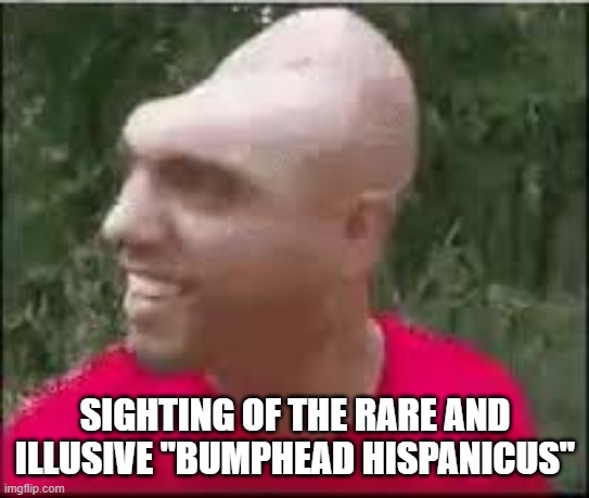 its rare and illusive | SIGHTING OF THE RARE AND ILLUSIVE "BUMPHEAD HISPANICUS" | image tagged in dishweed,rare,hispanic,bump,head | made w/ Imgflip meme maker