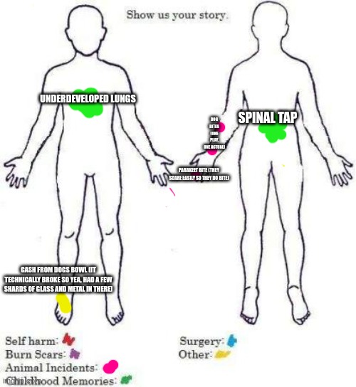 The actual pains I experienced, yea, I technically was stupid and chose a bad path and not the truth.... Sorry. | UNDERDEVELOPED LUNGS; DOG BITES (ONE PLAY, ONE ACTUAL); SPINAL TAP; PARAKEET BITE (THEY SCARE EASILY SO THEY DO BITE); GASH FROM DOGS BOWL (IT TECHNICALLY BROKE SO YEA, HAD A FEW SHARDS OF GLASS AND METAL IN THERE) | image tagged in show us your story | made w/ Imgflip meme maker