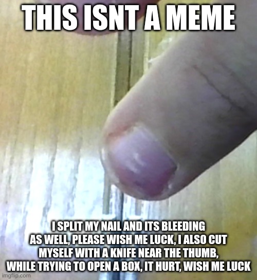 Please wish me luck, my hands are jacked up | THIS ISNT A MEME; I SPLIT MY NAIL AND ITS BLEEDING AS WELL, PLEASE WISH ME LUCK, I ALSO CUT MYSELF WITH A KNIFE NEAR THE THUMB, WHILE TRYING TO OPEN A BOX, IT HURT, WISH ME LUCK | image tagged in hurt,pain,bad luck | made w/ Imgflip meme maker