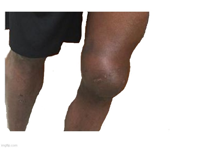 Knee Grow | image tagged in knee grow | made w/ Imgflip meme maker