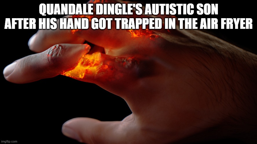 burning hand | QUANDALE DINGLE'S AUTISTIC SON AFTER HIS HAND GOT TRAPPED IN THE AIR FRYER | image tagged in burning hand | made w/ Imgflip meme maker
