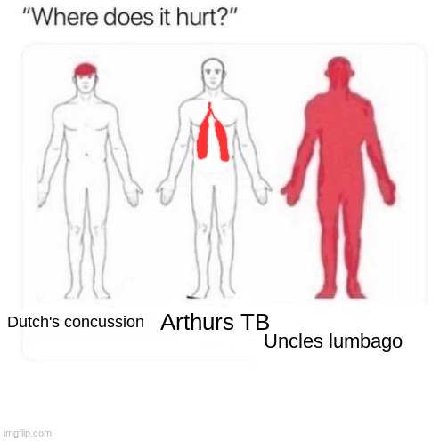 its a slow and painful death | Uncles lumbago; Arthurs TB; Dutch's concussion | image tagged in where does it hurt,memes,funny,rdr2,lumbago,arthur morgan | made w/ Imgflip meme maker