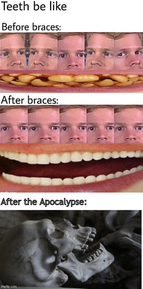 teeth be like | After the Apocalypse: | image tagged in memes,dark humor | made w/ Imgflip meme maker