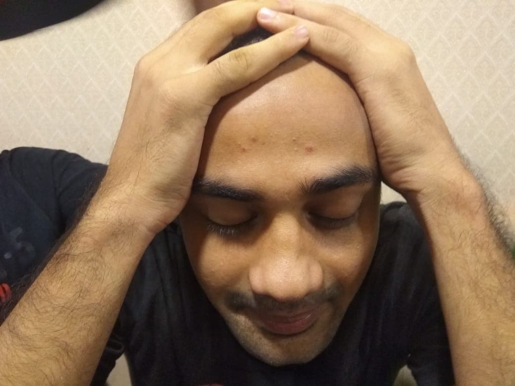 Hotash Anu Blank Meme Template