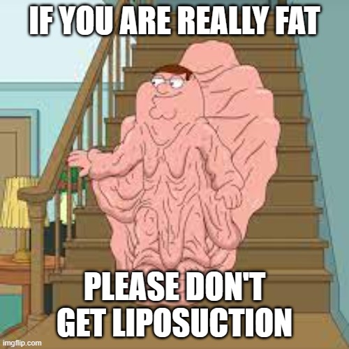 IF YOU ARE REALLY FAT; PLEASE DON'T GET LIPOSUCTION | image tagged in peter griffin,family guy peter,liposuction,fat loss,weight loss | made w/ Imgflip meme maker